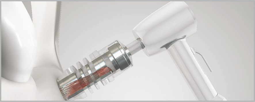 Drilling how to use ACM 3a